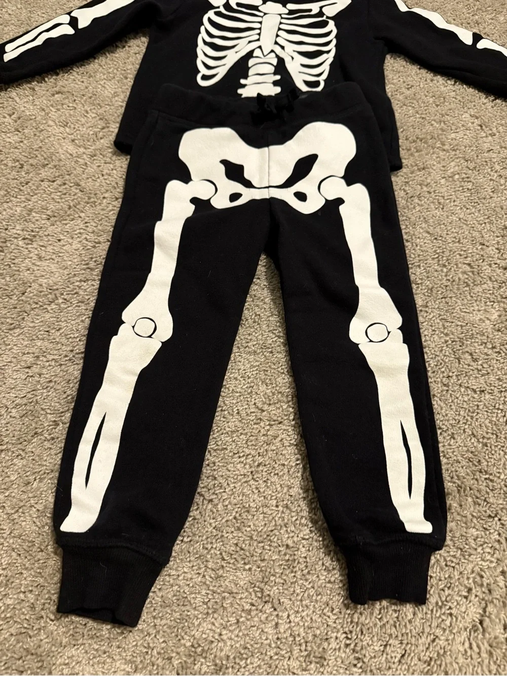 H&M Black and White Skeleton Hoodie & Jogger Set